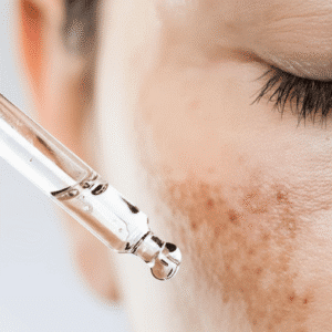 Even Tone Therapy ( Pigmentation)