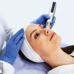 Bio Pen Advanced Skin Rejuvenation Treatment